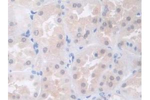 DAB staining on IHC-P; Samples: Human Kidney Tissue (COL4a5 Antikörper  (AA 1461-1685))