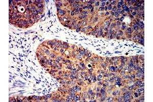 Immunohistochemistry (IHC) image for anti-BCL2-Like 2 (BCL2L2) (AA 6-118) antibody (ABIN5611241)