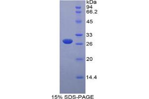 SDS-PAGE analysis of Mouse MYLK Protein.