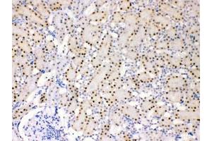 IHC testing of FFPE rat kidney with ADK antibody at 1ug/ml. (ADK Antikörper)