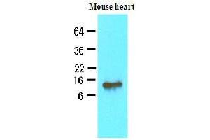 Western Blotting (WB) image for anti-Fatty Acid Binding Protein 4, Adipocyte (FABP4) (AA 1-132), (N-Term) antibody (ABIN336086) (FABP4 Antikörper  (N-Term))