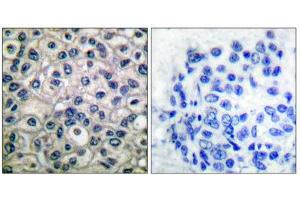 Immunohistochemistry (IHC) image for anti-Breast Cancer Anti-Estrogen Resistance 1 (BCAR1) (pTyr410) antibody (ABIN1847248) (BCAR1 Antikörper  (pTyr410))
