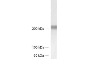 dilution: 1 : 1000, sample: brain homogenate from new born rats (TNC Antikörper)