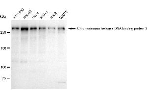 Western blotting analysis using Chromodomain helicase DNA binding protein 3 antibody (ABIN7798068). (Rekombinanter CHD3 Antikörper)