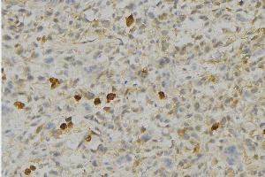 ABIN6276690 at 1/100 staining Human gastric tissue by IHC-P. (Peroxiredoxin 4 Antikörper  (C-Term))