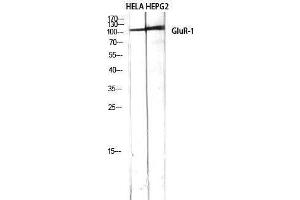 Western Blotting (WB) image for anti-Glutamate Receptor 1 (GLUR1) (Ser43) antibody (ABIN3175284) (Glutamate Receptor 1 Antikörper  (Ser43))