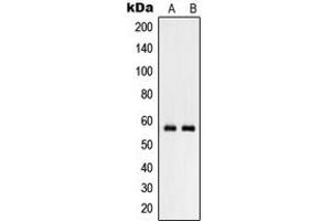 Western blot analysis of RHCG expression in NCIH460 (A), human testis (B) whole cell lysates.