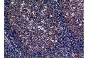 Immunohistochemistry (IHC) image for anti-Fc Fragment of IgA, Receptor For (FCAR) (Internal Region) antibody (ABIN6283252)