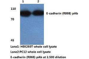 Western blot analysis of E-cadherin (pArg868) (E-cadherin Antikörper)