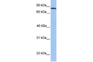 Human HeLa; WB Suggested Anti-ADAM7 Antibody Titration: 0. (ADAM7 Antikörper  (C-Term))