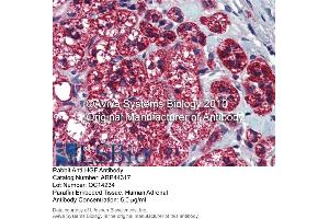 Immunohistochemistry (IHC) image for anti-Hepatocyte Growth Factor (Hepapoietin A, Scatter Factor) (HGF) (N-Term) antibody (ABIN2781816) (HGF Antikörper  (N-Term))