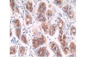 DAB staining on IHC-P; Samples: Human Stomach Tissue. (IFNA5 Antikörper  (AA 22-189))