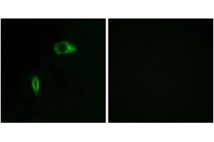 Immunofluorescence (IF) image for anti-Collagen, Type XIV, alpha 1 (COL14A1) (AA 71-120) antibody (ABIN2889924) (COL14A1 Antikörper  (AA 71-120))