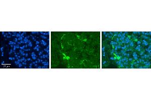 Rabbit Anti-PRDX2 Antibody     Formalin Fixed Paraffin Embedded Tissue: Human Pineal Tissue  Observed Staining: Cytoplasmic in cell bodies and processes of pinealocytes  Primary Antibody Concentration: 1:100  Other Working Concentrations: 1/600  Secondary Antibody: Donkey anti-Rabbit-Cy3  Secondary Antibody Concentration: 1:200  Magnification: 20X  Exposure Time: 0. (Peroxiredoxin 2 Antikörper  (Middle Region))