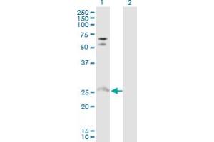 Western Blot analysis of MYO3A expression in transfected 293T cell line by MYO3A MaxPab polyclonal antibody. (MYO3A Antikörper  (AA 1-247))