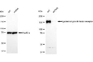 Western blotting analysis using Epidermal growth factor receptor antibody (ABIN7798476).