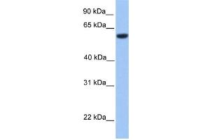WB Suggested Anti-ZNF545 Antibody Titration: 0. (Zinc finger protein 82 homolog (ZFP82) (C-Term) Antikörper)