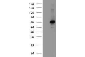 Image no. 1 for anti-Meis Homeobox 3 (MEIS3) (AA 1-261) antibody (ABIN1490668) (MEIS3 Antikörper  (AA 1-261))