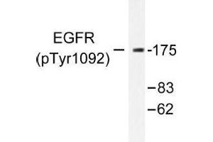 Image no. 1 for anti-Epidermal Growth Factor Receptor (EGFR) (pTyr1092) antibody (ABIN318011) (EGFR Antikörper  (pTyr1092))
