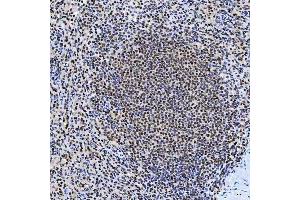 IHC analysis of SNRNP200 using anti-SNRNP200 antibody (ABIN7602032). (SNRNP200 Antikörper  (AA 557-2129))