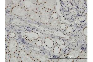 Image no. 2 for anti-Splicing Factor 3b, Subunit 2, 145kDa (SF3B2) (AA 592-646) antibody (ABIN599162) (SF3B2 Antikörper  (AA 592-646))
