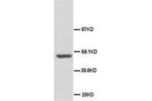 Western blot analysis of rat brain tissue lysis using ABI-1 antibody (ABI1 Antikörper  (C-Term))