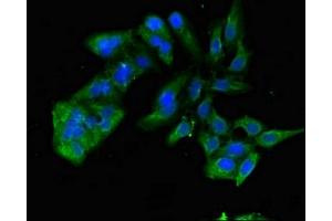 Immunofluorescent analysis of Hela cells using ABIN7172340 at dilution of 1:100 and Alexa Fluor 488-congugated AffiniPure Goat Anti-Rabbit IgG(H+L) (TNIK Antikörper  (AA 523-714))