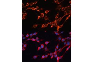 Immunofluorescence analysis of NIH/3T3 cells using SLC25 antibody (ABIN6132661, ABIN6147921, ABIN6147922 and ABIN6215721) at dilution of 1:100. (SLC25A24 Antikörper  (AA 1-200))