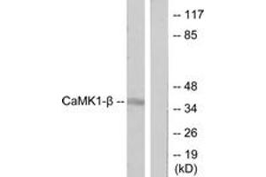 Western blot analysis of extracts from LOVO cells, treated with H2O2 100uM 30', using CaMK1-beta Antibody. (PNCK Antikörper  (AA 161-210))