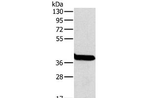 Western Blot analysis of Mouse liver tissue using OTC Polyclonal Antibody at dilution of 1:800 (OTC Antikörper)