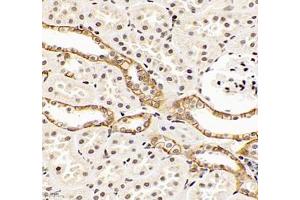 Immunohistochemistry of paraffin embedded rat kidney using EP0 (ABIN7073860) at dilution of 1: 900 (400x lens)