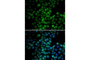 Immunofluorescence analysis of HeLa cells using C11orf30 antibody. (EMSY Antikörper)