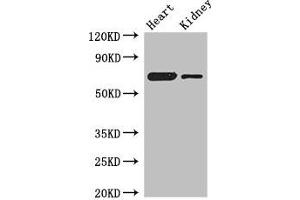 Western Blot Positive WB detected in: Mouse heart tissue, Mouse kidney tissue All lanes: ETFDH antibody at 3 μg/mL Secondary Goat polyclonal to rabbit IgG at 1/50000 dilution Predicted band size: 69, 63 kDa Observed band size: 69 kDa (ETFDH Antikörper  (AA 34-617))