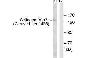 Western blot analysis of extracts from293 cells, treated with etoposide (25uM, 1hour), using COL4A3 (Cleaved-Leu1425) antibody. (COL4a3 Antikörper  (Cleaved-Leu1425))
