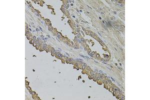Immunohistochemistry of paraffin-embedded human prostate using FMR1NB antibody (ABIN1876396) at dilution of 1:100 (40x lens). (FMR1NB Antikörper)