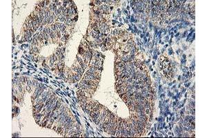 Image no. 2 for anti-DAN Domain Family, Member 5 (DAND5) (AA 23-189) antibody (ABIN1491235) (DAND5 Antikörper  (AA 23-189))