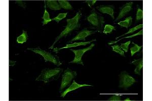 Immunofluorescence of monoclonal antibody to OCLN on HeLa cell. (Occludin Antikörper  (AA 423-522))