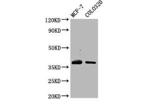 Western Blot Positive WB detected in: MCF-7 whole cell lysate, Colo320 whole cell lysate All lanes: PGLYRP3 antibody at 4. (PGLYRP3 Antikörper  (AA 90-222))