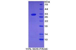 SDS-PAGE (SDS) image for Laminin, gamma 1 (LAMC1) (AA 1283-1551) protein (His tag) (ABIN2121529) (Laminin gamma 1 Protein (AA 1283-1551) (His tag))