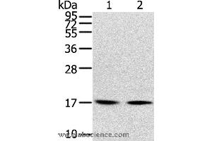 Western blot analysis of Human normal liver tissue and hepg2 cell, using RPLP1 Polyclonal Antibody at dilution of 1:400 (RPLP1 Antikörper)