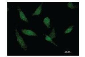 Immunofluorescence (IF) image for anti-TAF15 RNA Polymerase II, TATA Box Binding Protein (TBP)-Associated Factor, 68kDa (TAF15) antibody (ABIN930957)