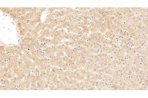 Detection of SERPINA10 in Human Liver Tissue using Monoclonal Antibody to Serpin A10 (SERPINA10)