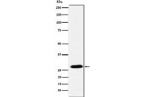 Western blot analysis of GSC expression in MCF7 cell lysate.