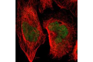 Immunofluorescent staining of human cell line A-431 with SENP1 polyclonal antibody  shows positivity in nucleus. (SENP1 Antikörper  (AA 85-204))