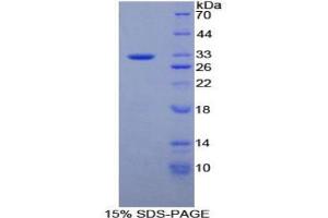 SDS-PAGE analysis of Human PTPRB Protein. (PTPRB Protein)