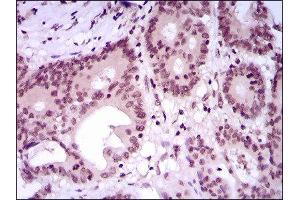 Immunohistochemistry (IHC) image for anti-Myocyte Enhancer Factor 2C (MEF2C) (AA 1-125) antibody (ABIN1846463)