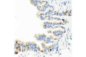 Immunohistochemistry of paraffin-embedded mouse lung using RGS5 antibody at dilution of 1:100 (x40 lens). (RGS5 Antikörper)