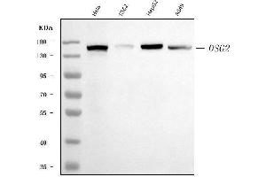 Western blot analysis of Desmoglein 2/DSG2 using anti-Desmoglein 2/DSG2 antibody (ABIN7600804).