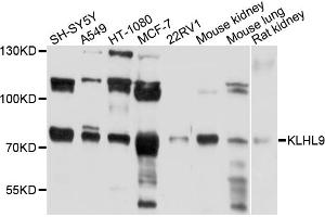 Western blot analysis of extracts of various cell lines, using KLHL9 antibody (ABIN4904169) at 1:1000 dilution. (KLHL9 Antikörper)