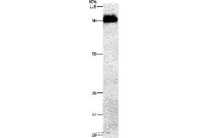 Western blot analysis of Mouse brain tissue, using APP Polyclonal Antibody at dilution of 1:1000 (beta Amyloid Antikörper)